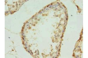 Immunohistochemistry of paraffin-embedded human testis tissue using ABIN7142361 at dilution of 1:100 (MRPL18 antibody  (AA 14-180))