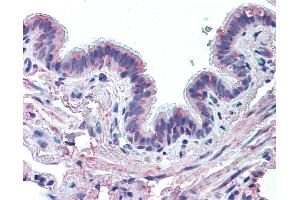 Anti-MUC13 antibody IHC of human lung, respiratory epithelium. (MUC13 antibody  (Extracellular Domain))