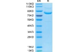 Biotinylated Human LRRC15 on Tris-Bis PAGE under reduced condition. (LRRC15 Protein (AA 22-538) (His-Avi Tag,Biotin))