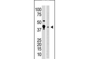 Antibody is used in Western blot to detect MBD2 in A375 cell lysate (lane 1) and mouse brain tissue lysate (lane 2) lysate. (MBD2 antibody  (N-Term))