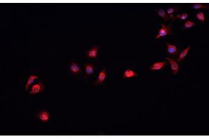 Immunofluorescence (fixed cells) (IF/ICC) image for anti-SMAD, Mothers Against DPP Homolog 2 (SMAD2) (C-Term) antibody (ABIN6265170)