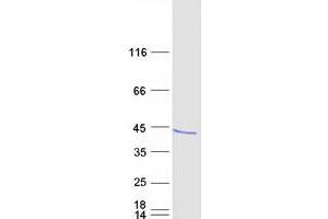 Western Blotting (WB) image for RCAN Family Member 3 (RCAN3) protein (Myc-DYKDDDDK Tag) (ABIN2713040)
