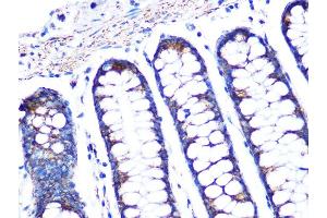 Immunohistochemistry of paraffin-embedded human colon using PBR/TSPORabbit mAb (ABIN1679051, ABIN3019258, ABIN3019259 and ABIN7101738) at dilution of 1:100 (40x lens). (TSPO antibody)