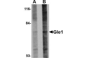 Western Blotting (WB) image for anti-GLE1 RNA Export Mediator (GLE1) (Middle Region) antibody (ABIN1030940) (GLE1 antibody  (Middle Region))