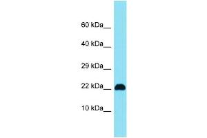Host: Rabbit Target Name: C15orf32 Sample Type: Jurkat Whole Cell lysates Antibody Dilution: 1. (C15ORF32 antibody  (N-Term))