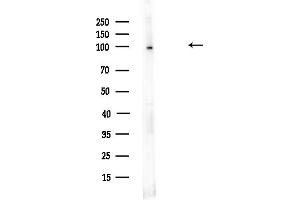 anti-Insulin-Degrading Enzyme (IDE) (N-Term) antibody