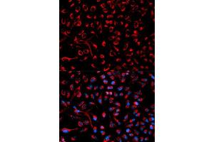 Immunofluorescence analysis of HeLa cell using DOK4 antibody. (DOK4 antibody  (AA 240-326))