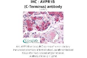 Image no. 2 for anti-Arginine Vasopressin Receptor 1B (AVPR1B) (C-Term) antibody (ABIN1732149) (AVPR1B antibody  (C-Term))