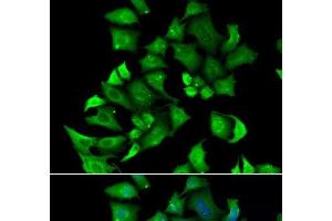 Immunofluorescence analysis of A549 cells using ENTPD2 Polyclonal Antibody (ENTPD2 antibody)