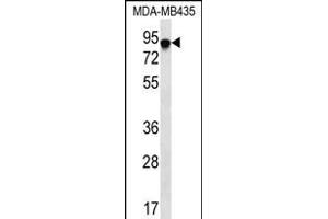 FYB Antibody (C-term) (ABIN656241 and ABIN2845557) western blot analysis in MDA-M cell line lysates (35 μg/lane). (FYB antibody  (C-Term))