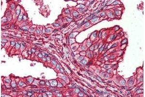 Human Prostate (formalin-fixed, paraffin-embedded) stained with HSPB6 antibody ABIN364293 at 2. (HSPB6 antibody)