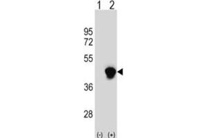 Western Blotting (WB) image for anti-Enoyl-CoA Delta Isomerase 2 (PECI) antibody (ABIN3003871) (PECI/ECI2 antibody)