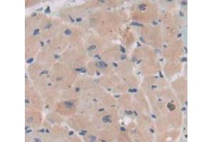 Used in DAB staining on fromalin fixed paraffin- embedded Kidney tissue (BMX antibody  (AA 209-446))