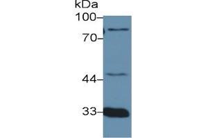 Mouse Capture antibody from the kit in WB with Positive Control: Human urine. (Prothrombin Fragment 1+2 ELISA Kit)
