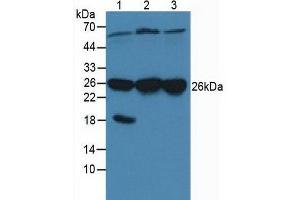 Western blot analysis of (1) Porcine Brain Tissue, (2) Human HeLa cells and (3) Human A431 Cells. (CACYBP antibody  (AA 2-228))
