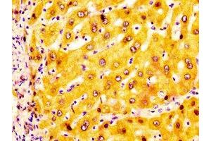 IHC image of ABIN7143641 diluted at 1:200 and staining in paraffin-embedded human liver tissue performed on a Leica BondTM system. (ADH1A antibody  (AA 104-253))