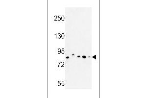 Western blot analysis of CHPF Antibody in MDA-MB435, MCF-7, HepG2, A375 cell line and mouse testis tissue lysates (35ug/lane) (CHPF antibody  (AA 327-354))