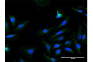 Immunofluorescence of purified MaxPab antibody to KLK7 on HeLa cell. (Kallikrein 7 antibody  (AA 1-253))