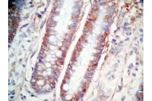 Human colon tissue was stained by Rabbit Anti-CCK (26-33)  (Human,Rat) Antibody (Cholecystokinin antibody  (non-sulfated))
