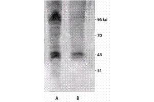 Western blot analysis of Mouse brain cell lysates showing detection of Phosphothreonine protein using Rabbit Anti-Phosphothreonine Polyclonal Antibody . (Phosphothreonine antibody  (Atto 390))