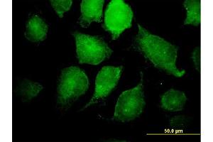 Immunofluorescence (IF) image for anti-Inhibitor of kappa Light Polypeptide Gene Enhancer in B-Cells, Kinase gamma (IKBKG) (AA 1-419) antibody (ABIN563664)