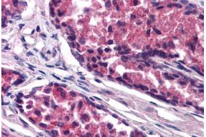 Human Prostate (formalin-fixed, paraffin-embedded) stained with SNX26 antibody ABIN290201 at 1. (SNX26 antibody  (AA 3-14))