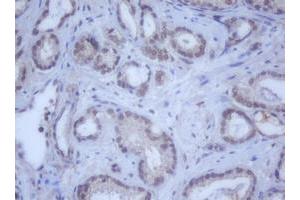 Image no. 9 for anti-DEAD (Asp-Glu-Ala-Asp) Box Polypeptide 59 (DDX59) (AA 1-303) antibody (ABIN1490728)