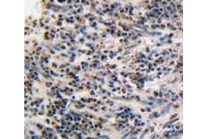 IHC-P analysis of esophagus tissue, with DAB staining.