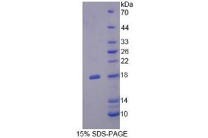 Image no. 1 for Fibronectin Leucine Rich Transmembrane Protein 3 (FLRT3) (AA 29-152) protein (His tag) (ABIN4990424)
