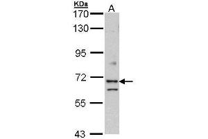 WB Image Sample (30 ug of whole cell lysate) A: Hela 7. (EXOC7 antibody)