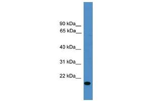 WB Suggested Anti-VEGFB  Antibody Titration: 0. (VEGFB antibody  (Middle Region))