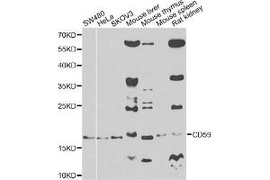 Western blot analysis of extracts of various cell lines, using CD59 antibody. (CD59 antibody)