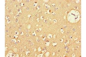 Immunohistochemistry of paraffin-embedded human brain tissue using ABIN7146119 at dilution of 1:100