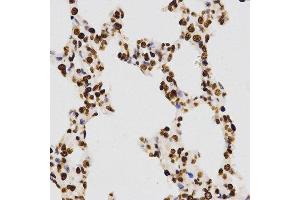 Immunohistochemistry (IHC) image for anti-Histone H3 (H3) (H3K27me) antibody (ABIN3023266) (Histone 3 antibody  (H3K27me))