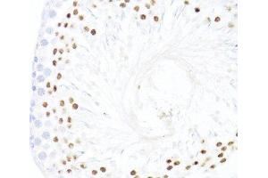 Immunohistochemistry of paraffin-embedded Rat testis using DDX59 Polyclonal Antibody at dilution of 1:100 (40x lens). (DDX59 antibody)