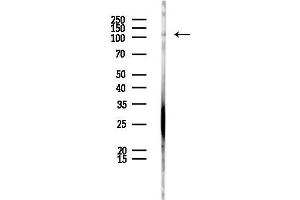 Western blot analysis of lysates from PC12 cells, using AP2 Antibody at 1/1000 dilution.