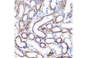 Immunohistochemistry of paraffin-embedded Mouse kidney using FGF2 Rabbit pAb (ABIN3020744, ABIN3020745, ABIN3020746 and ABIN6213702) at dilution of 1:100 (40x lens). (FGF2 antibody  (AA 143-288))