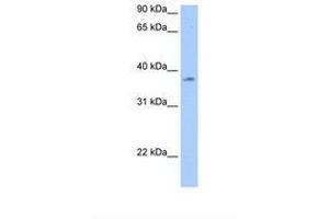 Image no. 1 for anti-RNA Binding Motif Protein, Y-Linked Family 1 Member A1 (RBMY1A1) (AA 141-190) antibody (ABIN6737904) (RBMY1A1 antibody  (AA 141-190))