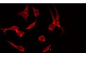 ABIN6275575 staining NIH-3T3 by IF/ICC. (SLC4A11 antibody  (Internal Region))