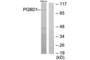 Western Blotting (WB) image for anti-PiggyBac Transposable Element Derived 1 (PGBD1) (AA 241-290) antibody (ABIN2889725)