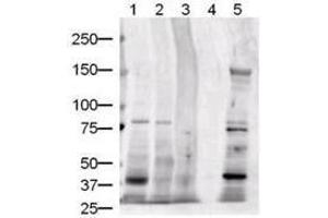 Western blot using  Protein A purified anti-Jagged-1 antibody shows detection of Jagged-1 protein in various whole cell lysates: human brain (lane 1), human kidney (lane 2), human liver (lane 3), and mouse liver (lane 5). (JAG1 antibody  (Internal Region))