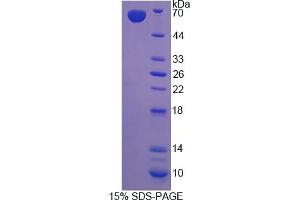 Image no. 1 for Laminin, beta 2 (Laminin S) (LAMB2) (AA 38-350) protein (His tag,GST tag) (ABIN6236828) (LAMB2 Protein (AA 38-350) (His tag,GST tag))