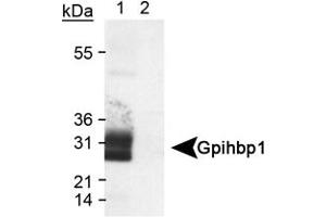 Western blot analysis of Gpihbp1 in transfected lysate (Lane 1) using Gpihbp1 polyclonal antibody . (GPIHBP1 antibody  (AA 170-250))