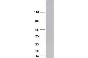 Validation with Western Blot (MYH6 Protein (Myc-DYKDDDDK Tag))