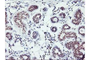 Immunohistochemical staining of paraffin-embedded Human breast tissue using anti-RNF113B mouse monoclonal antibody. (RNF113B antibody)