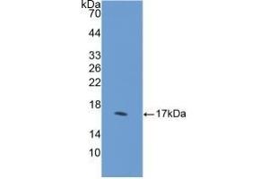 Detection of Recombinant DHH, Human using Polyclonal Antibody to Hedgehog Homolog, Desert (DHH) (desert Hedgehog antibody  (AA 241-383))