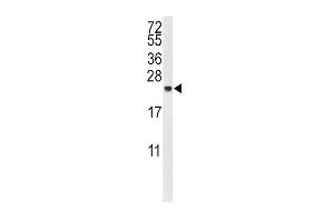 Western blot analysis of IL10 Antibody (Center) (ABIN653057 and ABIN2842660) in MDA-M cell line lysates (35 μg/lane). (IL-10 antibody  (AA 27-53))