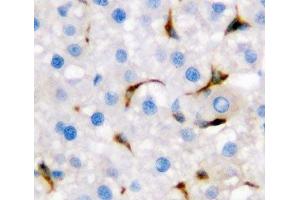 IHC-P: CD68 antibody testing of rat liver tissue
