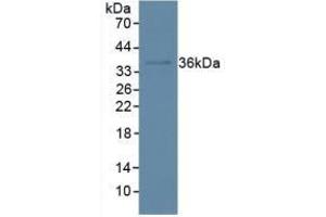 Detection of IkBa in Human Hela Cells using Polyclonal Antibody to Inhibitory Subunit Of NF Kappa B Alpha (IkBa) (Inhibitory Subunit Of NF kappa B alpha (AA 74-247) antibody)
