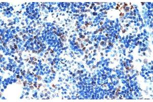 Immunohistochemistry of paraffin-embedded Rat spleen using AQR Polyclonal Antibody at dilution of 1:100 (40x lens).
